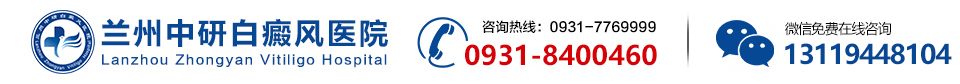 兰州看白癜风的专科医院