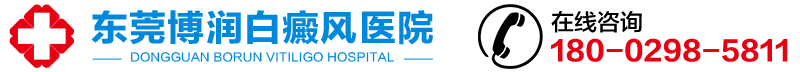 东莞长安白癜风医院