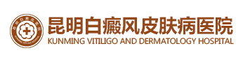 云南昆明白癜风医院哪家好