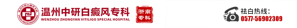 温州白癜风