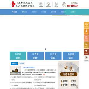 「长春银康牛皮癣医院」怎么样